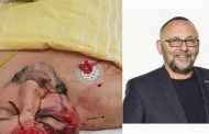 Alternative for Germany chairman left with severe head injuries after violent attack